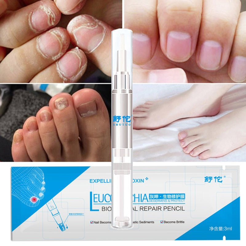 Nail Fungus Treatment